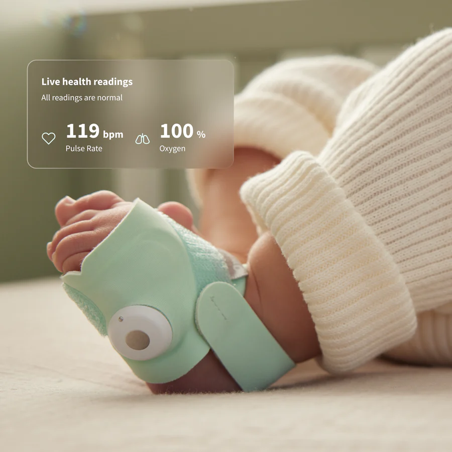 Baby Monitring WearableOwlet Dream Sock